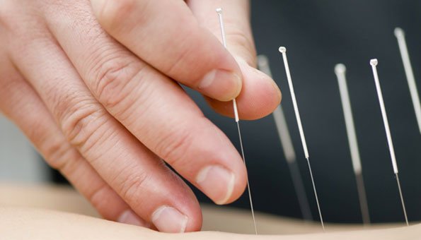 Akupunktur löst Blockaden der Energieströme im Körper.